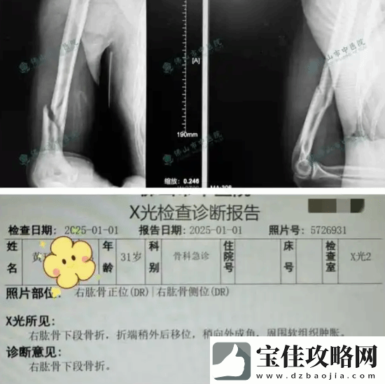 俩小伙挑战与机器人“掰手腕”