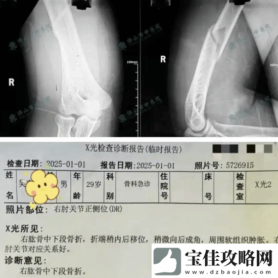 俩小伙挑战与机器人“掰手腕”