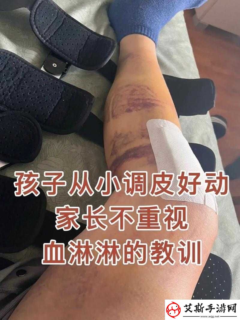 闯祸后臭小子让姨妈腰快断了：孩子调皮的后果真严重