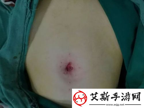 梦境中的奇幻旅程：肚皮被顶的一鼓一鼓的