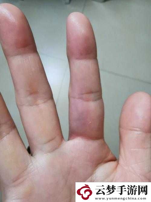 才用一根手指头就喊疼究竟意味着什么呢